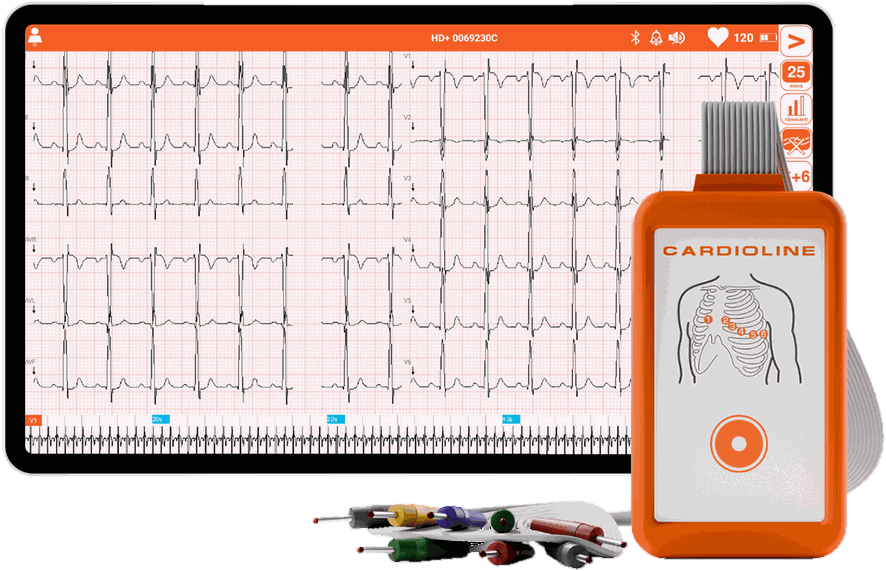 Электрокардиограф Cardioline TouchECG