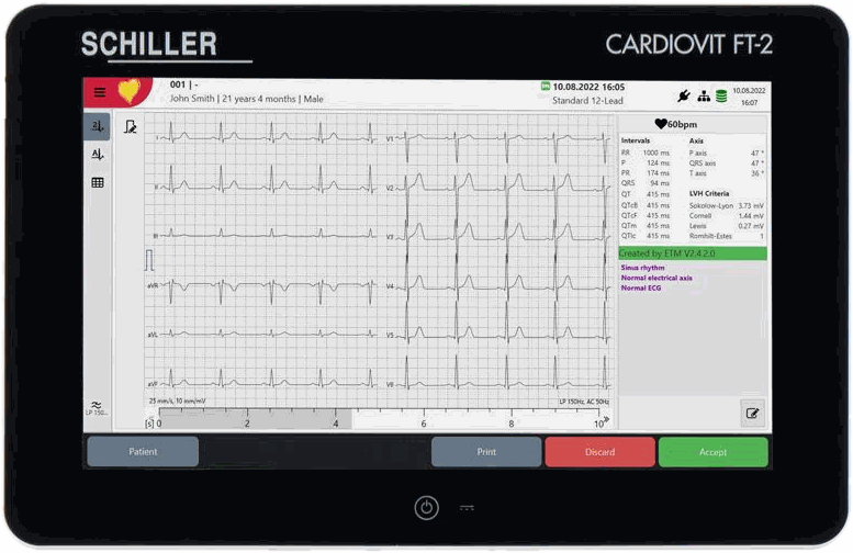 Электрокардиограф Schiller CARDIOVIT FT-2